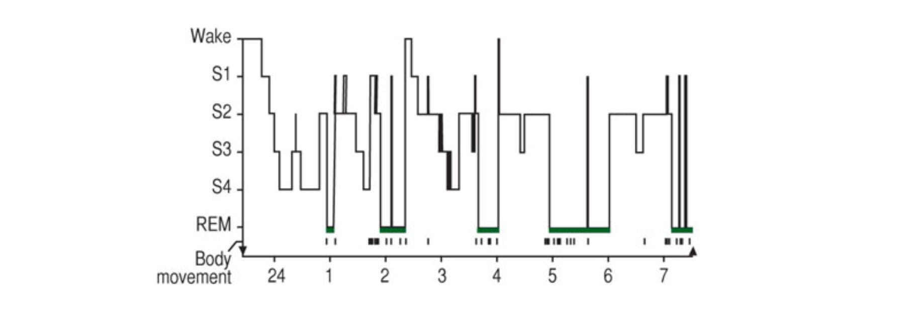 Measuring Sleep